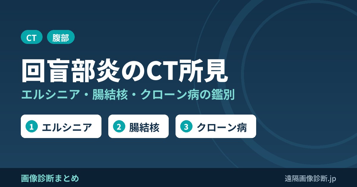 回盲部炎(回盲部の腸炎)の鑑別とCT画像所見｜回盲部とは？エルシニア・腸結核・クローン病