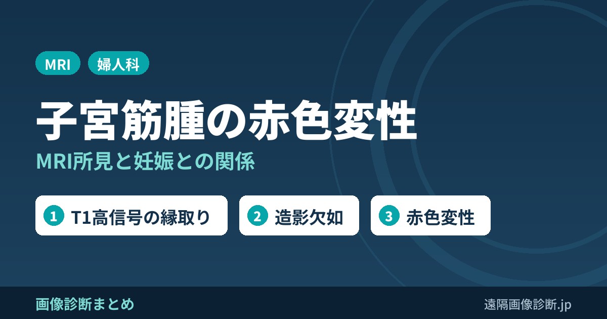 子宮筋腫の赤色変性とは？MRI画像所見(T1高信号の縁取り・造影欠如)と妊娠との関係