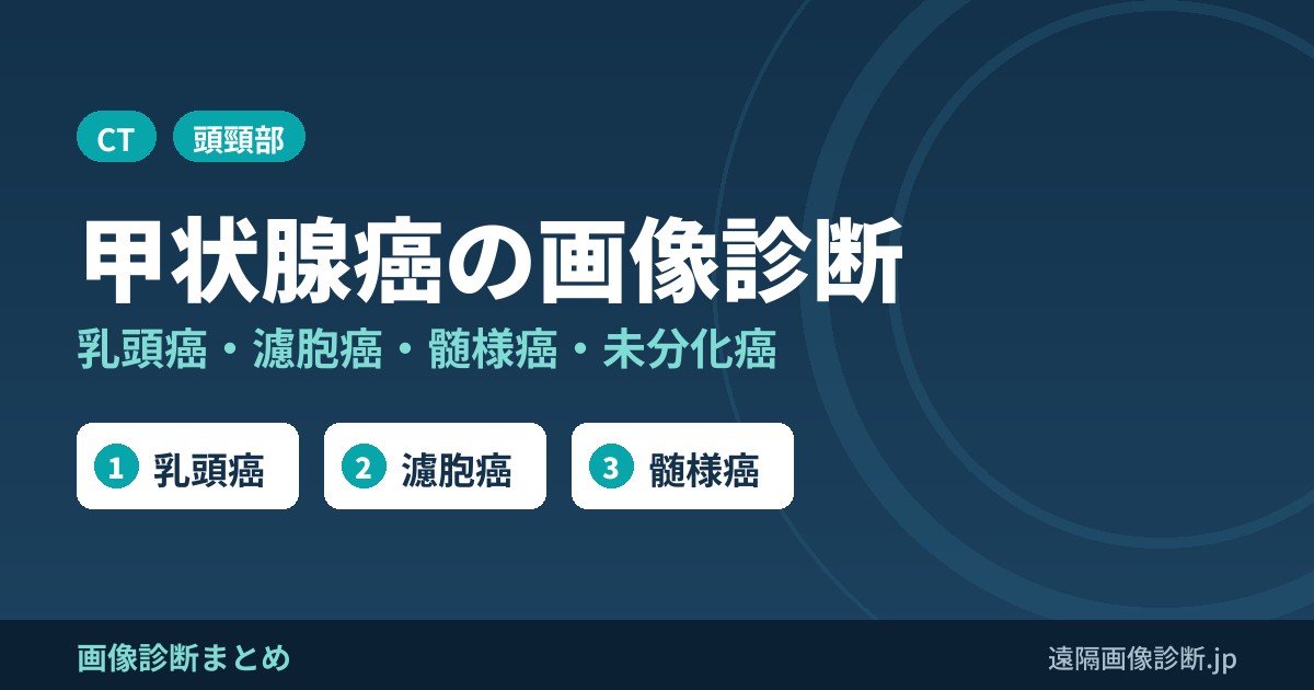 甲状腺癌の画像診断と転移の特徴｜乳頭癌・濾胞癌・髄様癌・未分化癌