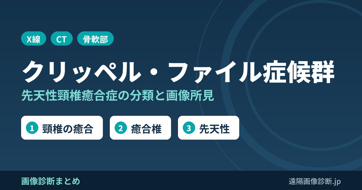 クリッペル・ファイル症候群(Klippel-Feil症候群)とは？先天性頸椎癒合症の症状・分類と画像所見(癒合椎)