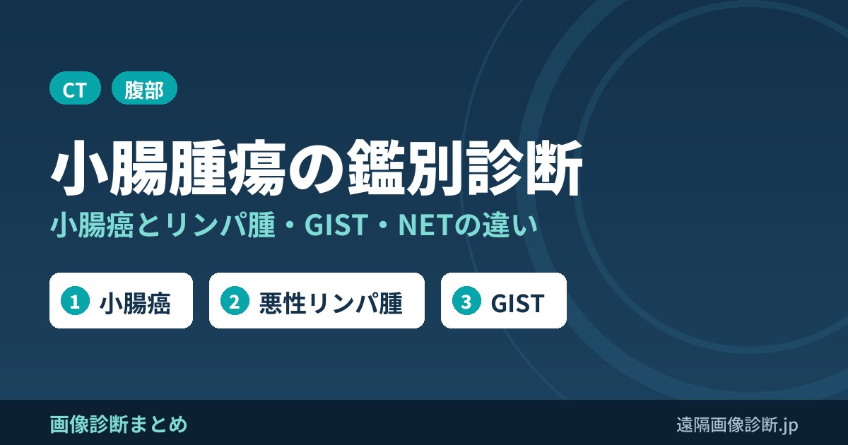 小腸腫瘍の鑑別診断と小腸癌のCT画像所見｜リンパ腫・GIST・NETとの違い