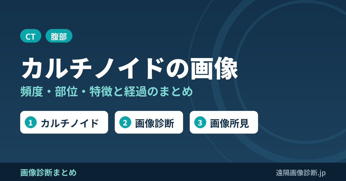 カルチノイドとは？頻度、部位、特徴、経過、画像診断、画像所見まとめ