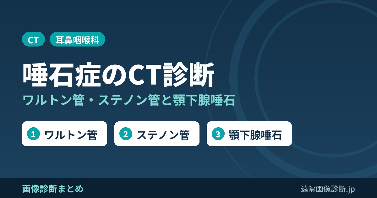 唾石症とは？ワルトン管・ステノン管の位置と症状、CT画像診断と手術(顎下腺唾石)