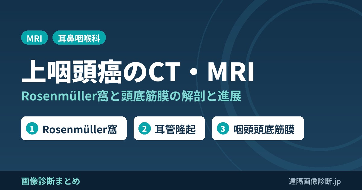 上咽頭癌のCT・MRI画像診断｜Rosenmüller窩・耳管・咽頭頭底筋膜の解剖と進展