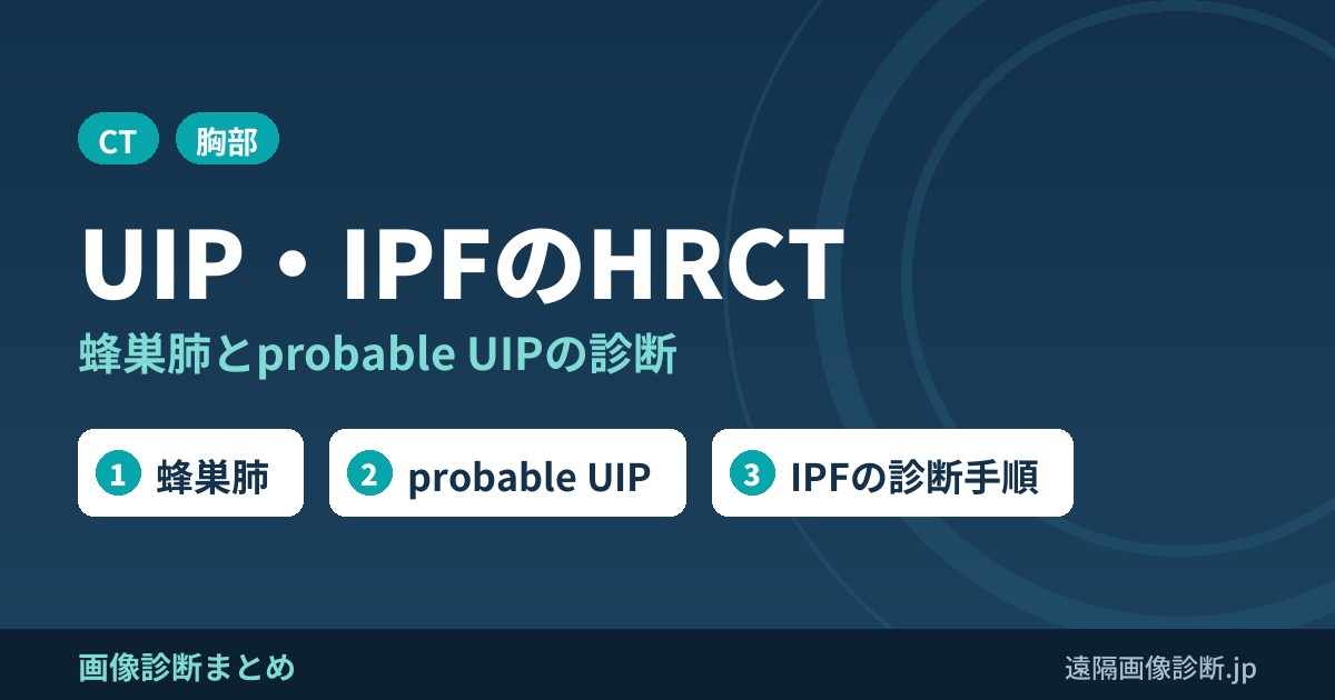 通常型間質性肺炎(UIP)と特発性肺線維症(IPF)のHRCT画像診断｜蜂巣肺・probable UIP