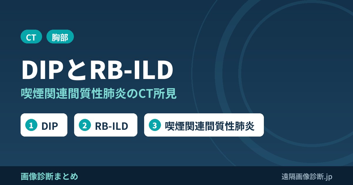 剥離性間質性肺炎(DIP)・RB-ILDのCT画像所見｜喫煙関連間質性肺炎