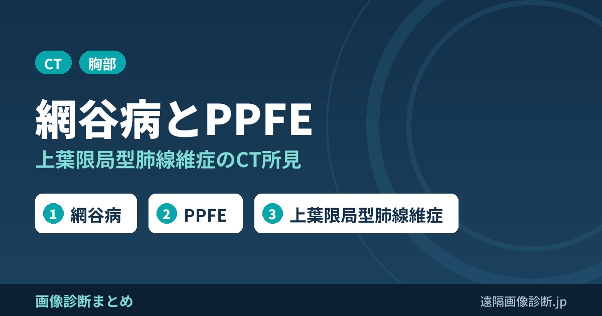 網谷病(特発性上葉限局型肺線維症)とPPFEとは？CT画像所見と特徴