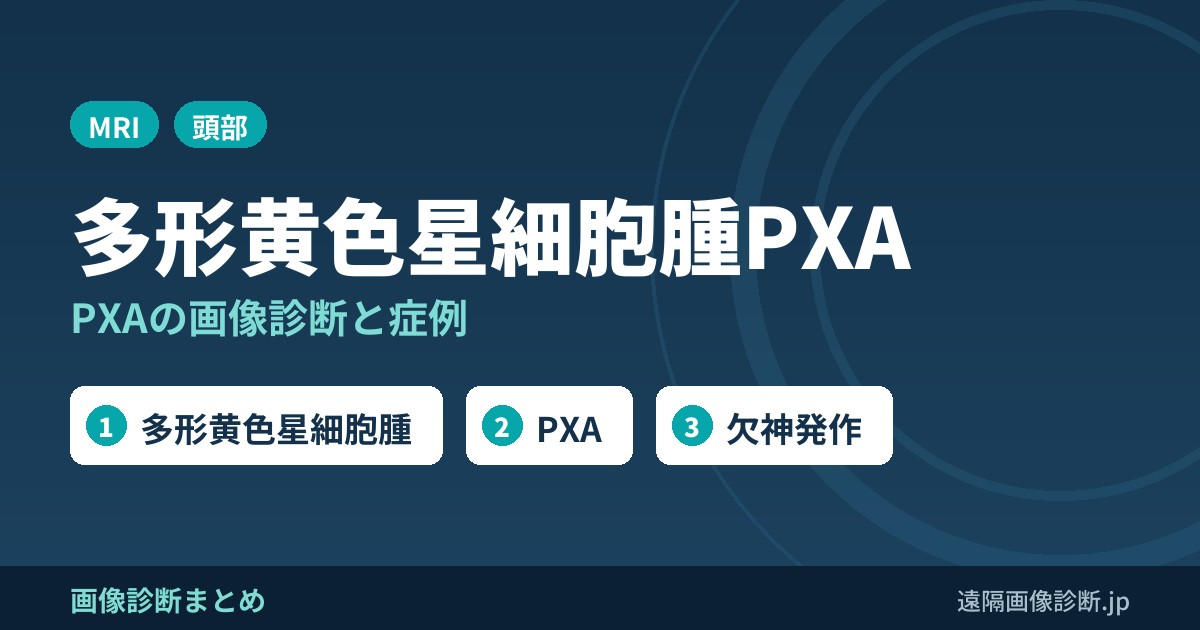 多形黄色星細胞腫の画像診断(pleomorphic xanthoastrocytoma:PXA)