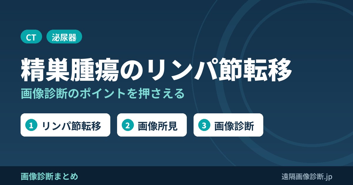 精巣腫瘍のリンパ節転移の特徴は？画像診断のポイント！