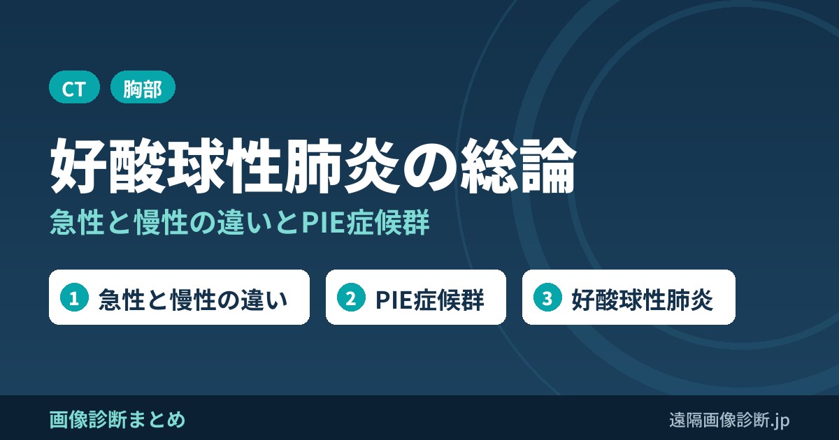 好酸球性肺炎総論(急性と慢性の違いは？PIE症候群とは？)