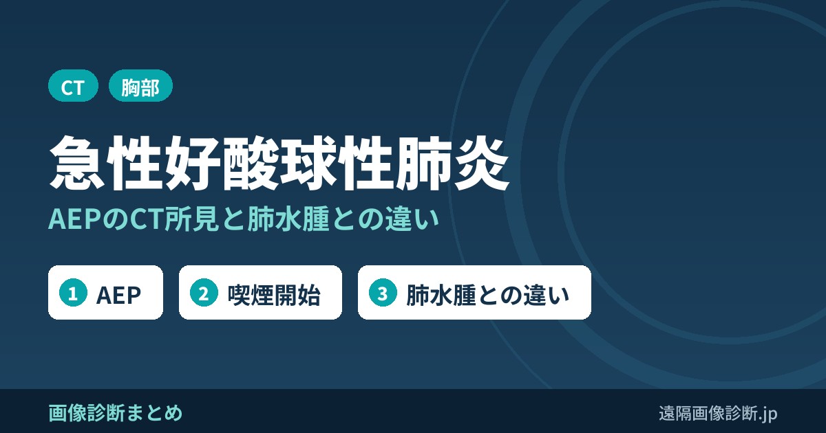 急性好酸球性肺炎(AEP)のCT画像所見｜喫煙開始との関係と肺水腫との違い