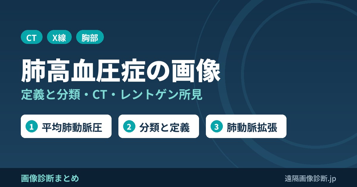 肺高血圧症の画像診断｜定義(平均肺動脈圧20mmHg超)・分類とCT・レントゲン所見