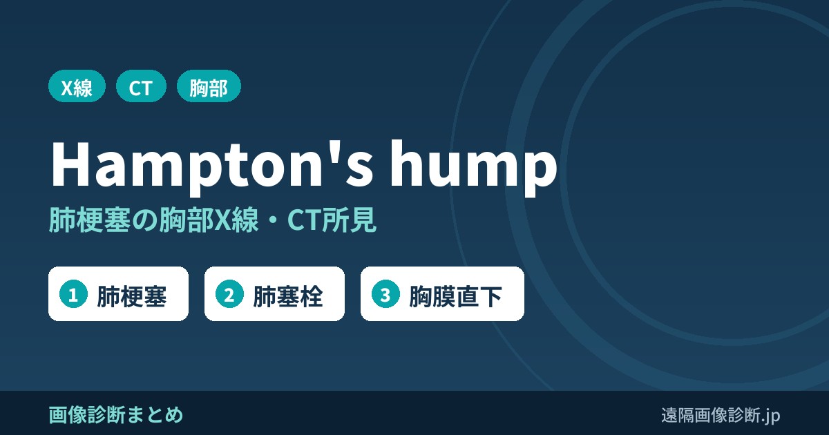 Hampton's hump(ハンプトンハンプ)とは？肺梗塞の胸部X線・CT所見