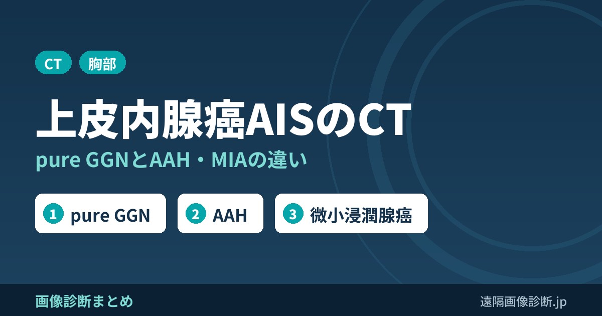 上皮内腺癌(AIS)のCT画像所見｜pure GGNとAAH・微小浸潤腺癌との違い
