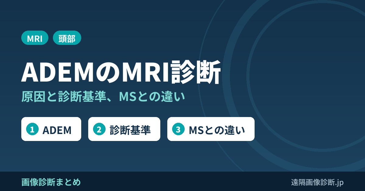 ADEM(急性散在性脳脊髄炎)とは？原因・症状・診断基準と後遺症、MRI画像所見(MSとの違い)