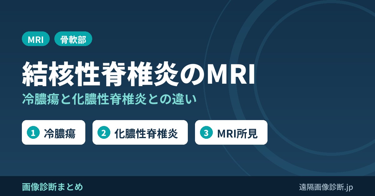 結核性脊椎炎(脊椎カリエス)の画像診断｜冷膿瘍とは？化膿性脊椎炎との違いとMRI所見
