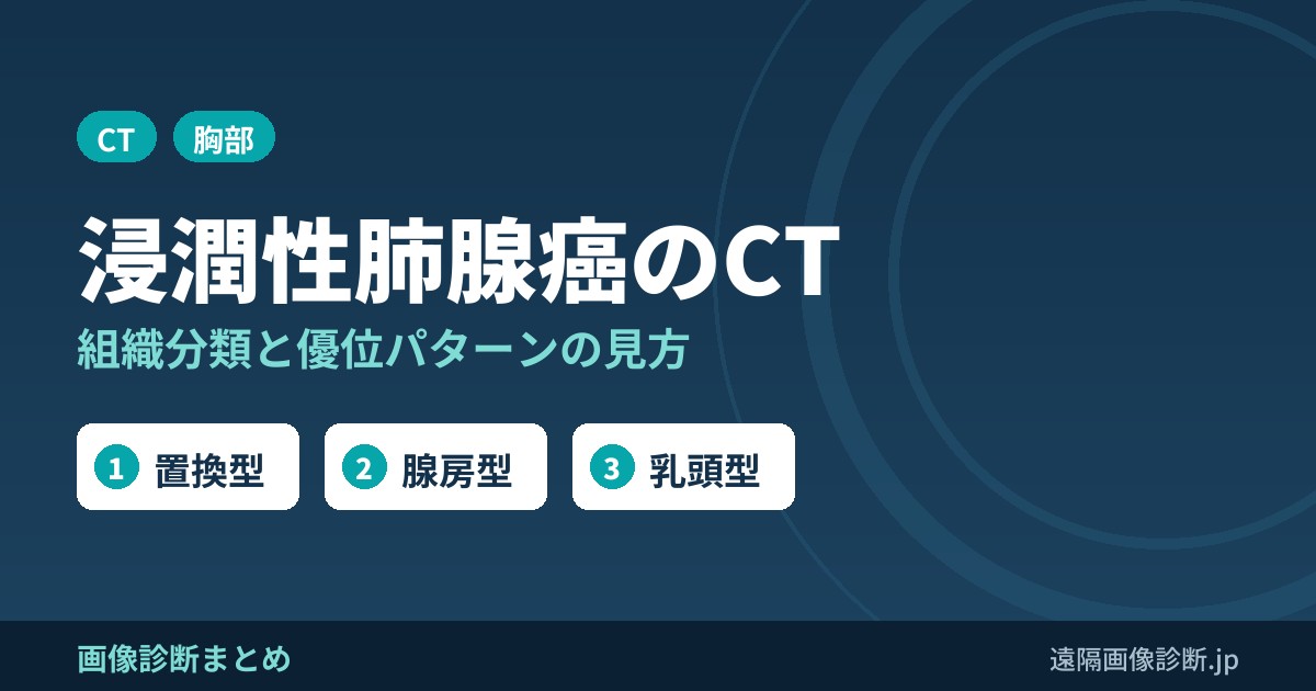 浸潤性肺腺癌のCT画像所見と組織分類｜優位パターンと浸潤性粘液性腺癌