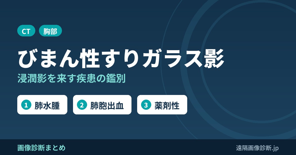 びまん性浸潤影・すりガラス影を来す疾患の鑑別｜感染・肺水腫・肺胞出血・薬剤性など