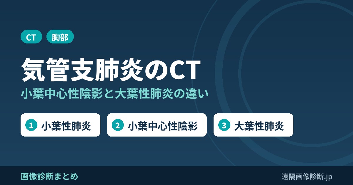気管支肺炎(小葉性肺炎)のCT画像診断｜小葉中心性陰影と大葉性肺炎との違い