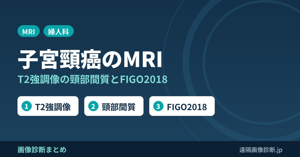 子宮頸癌のMRI画像診断｜T2強調像での頸部間質の評価とFIGO2018進行期分類
