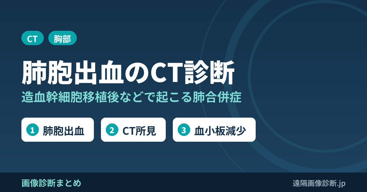 肺胞出血のCT画像診断｜造血幹細胞移植後・血小板減少で起こる肺合併症