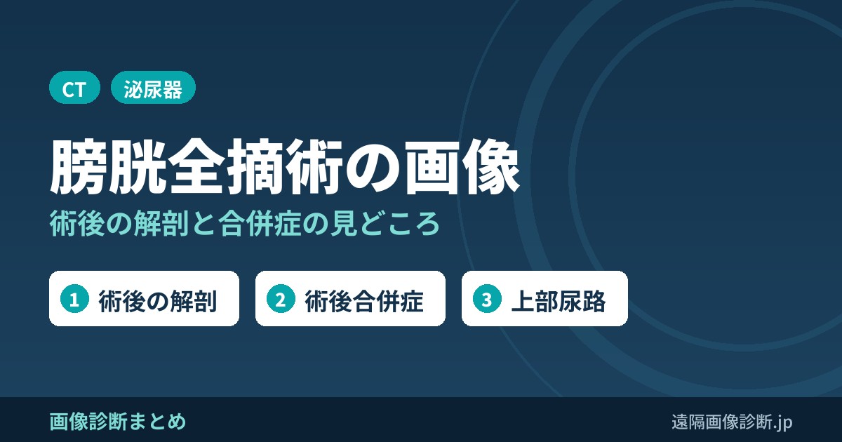 膀胱全摘術(total cystectomy)で注意すべき画像診断、画像所見