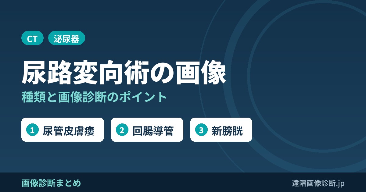 尿路変向術(urinary diversion)の種類と画像診断のポイント