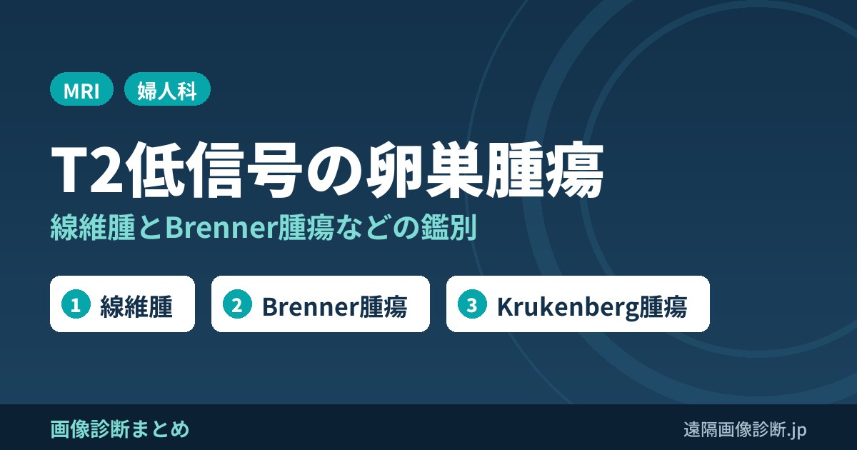 T2強調像で低信号を呈する卵巣腫瘍の鑑別｜線維腫・Brenner腫瘍・Krukenberg腫瘍など