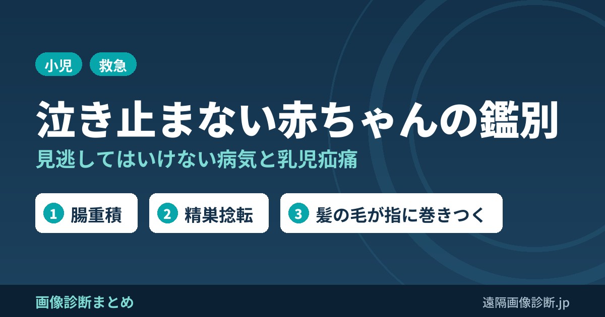 泣き止まない赤ちゃんを見たときの鑑別診断（夜泣き、乳児、乳児疝痛）