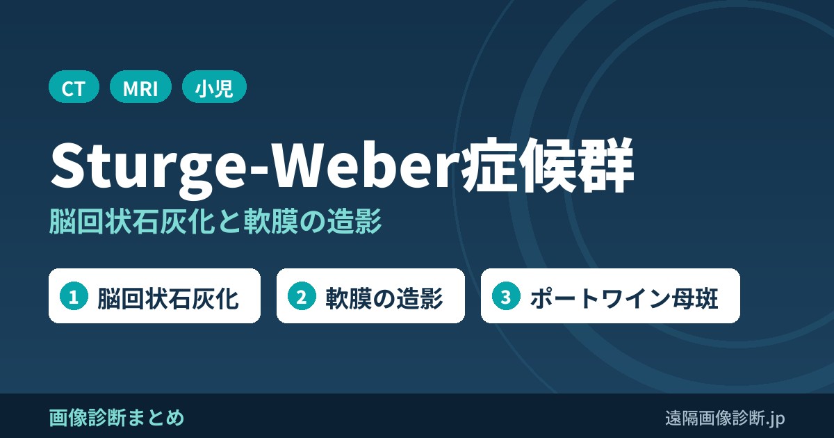 Sturge-Weber症候群のCT・MRI画像所見｜脳回状石灰化と軟膜の造影