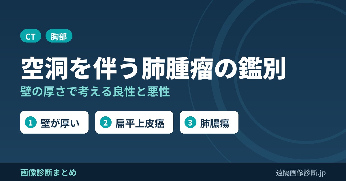 空洞を伴う肺腫瘤の鑑別診断｜壁の厚さで考える良性・悪性
