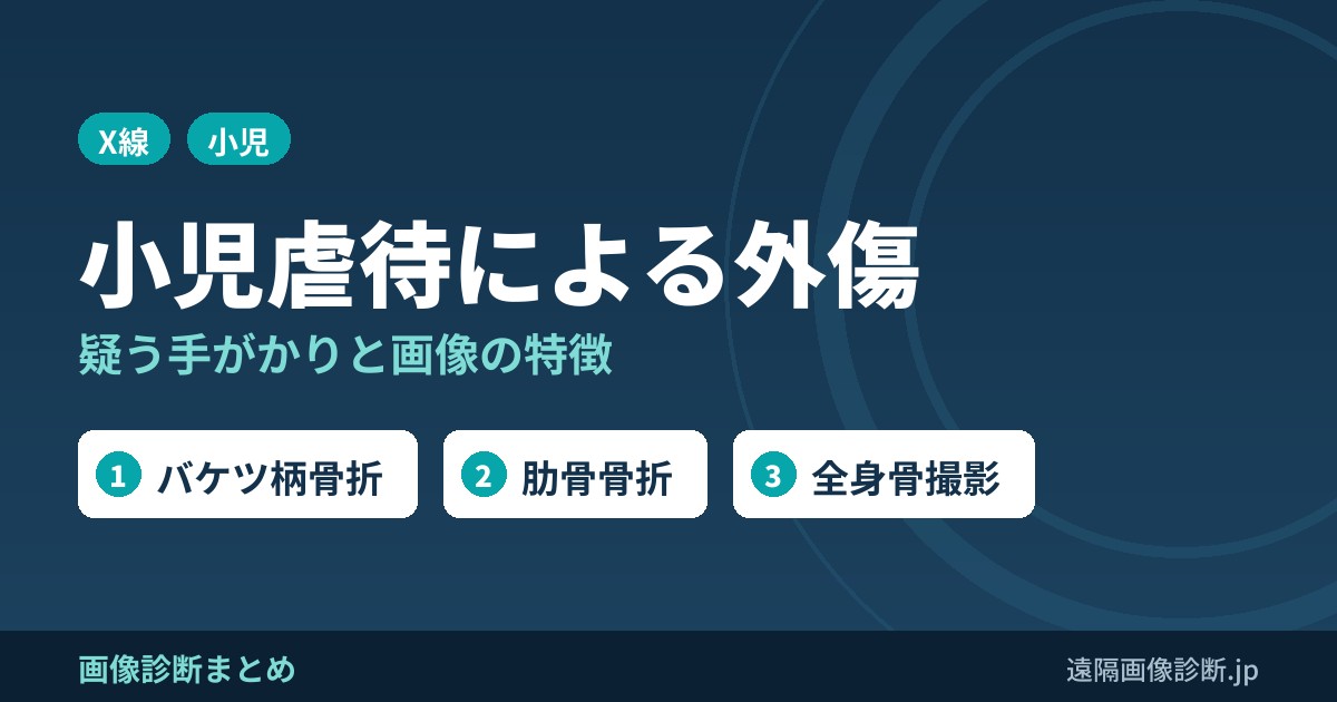 小児虐待による外傷の特徴と診断