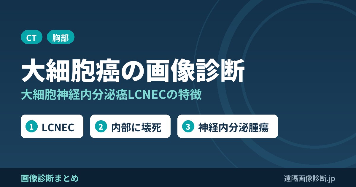 大細胞癌(大細胞神経内分泌癌)の画像診断