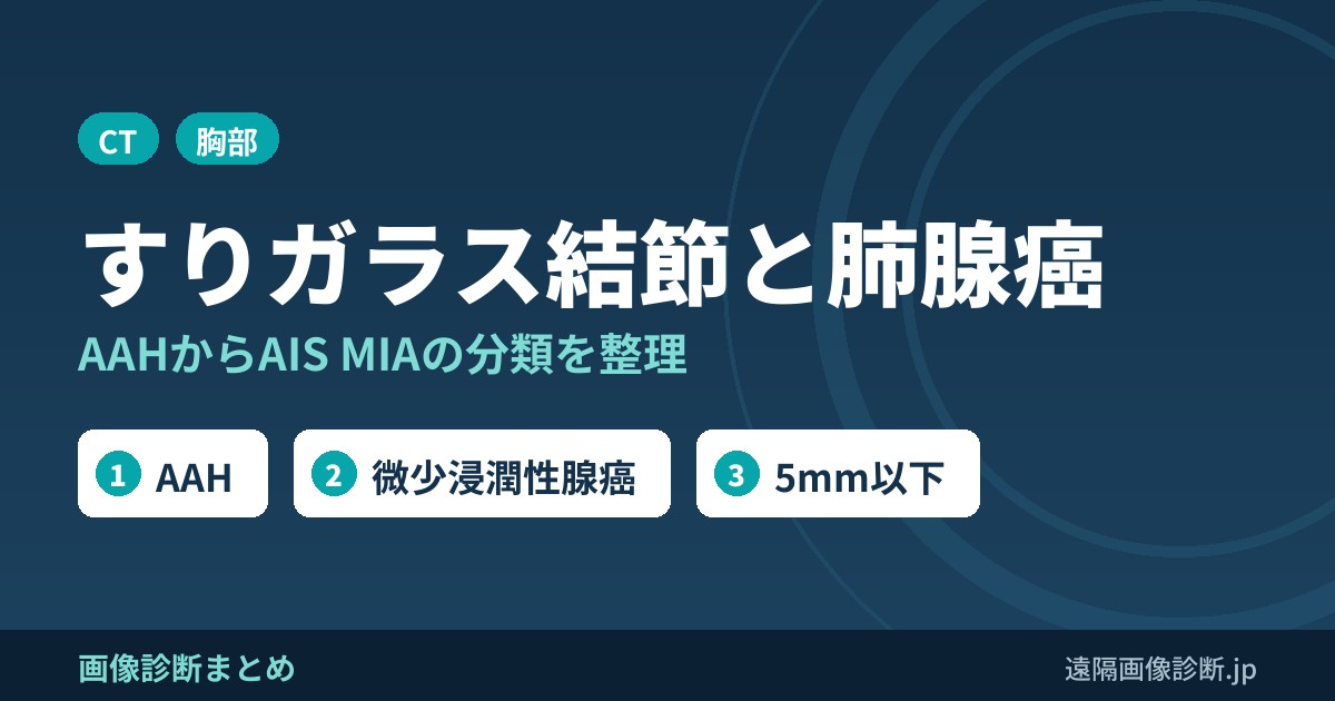 すりガラス結節(GGN)のCT所見と肺腺癌の分類｜AAH・AIS・MIA・浸潤性腺癌(BACとは言わない)