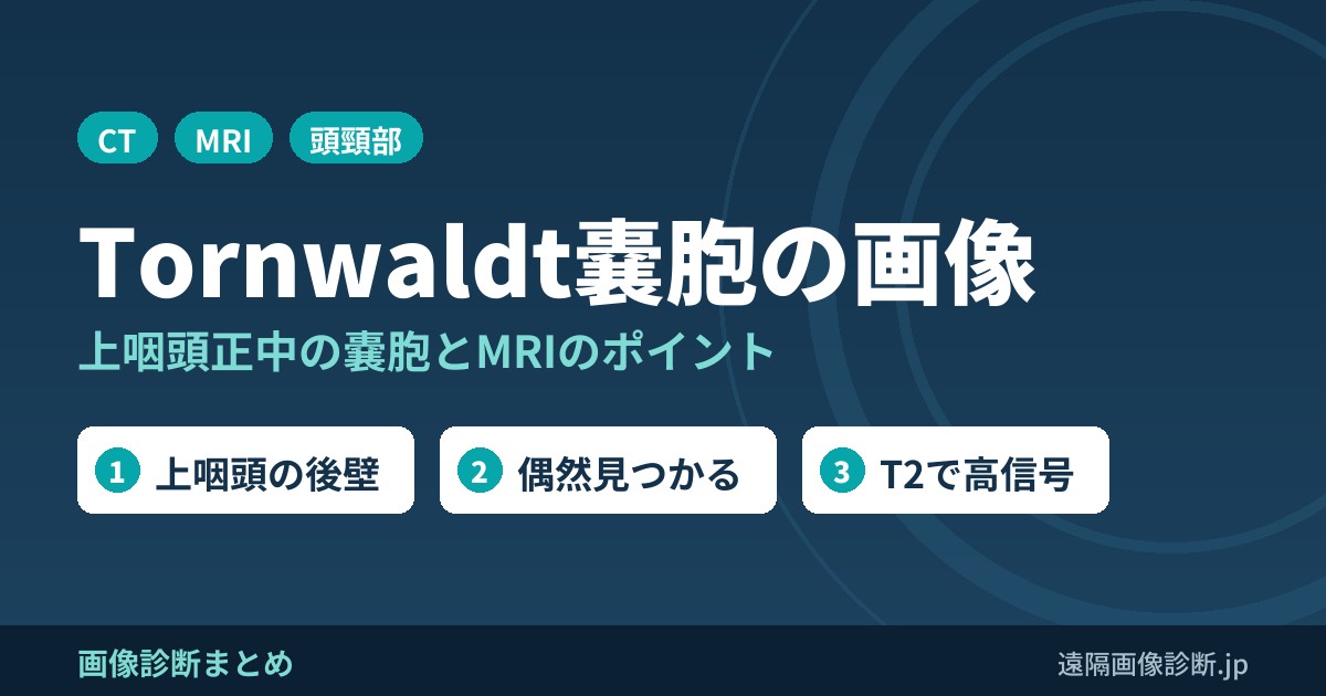 Tornwaldt嚢胞とは？CT,MRI画像診断のポイントは？