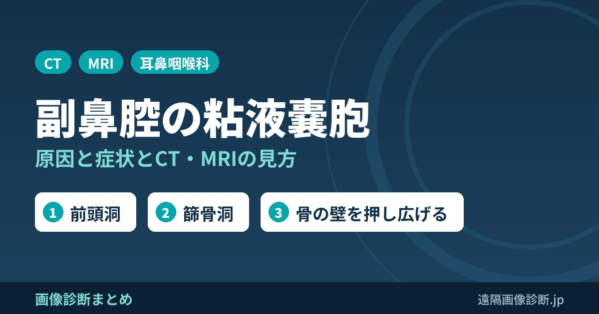 副鼻腔の粘液嚢胞(粘液瘤・ムコセル)とは？原因・症状とCT・MRI画像所見