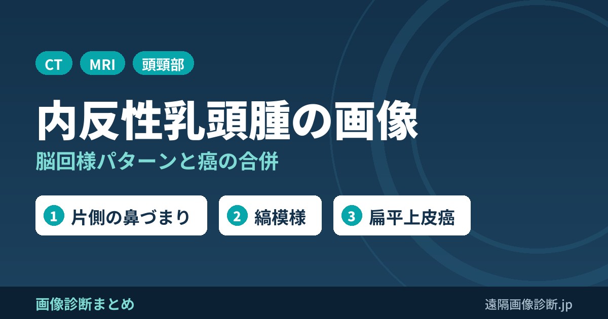 内反性乳頭腫(inverted papilloma)のCT・MRI画像所見｜脳回様パターンと癌の合併
