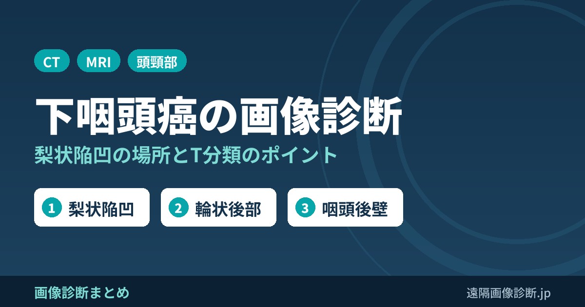 下咽頭癌の画像診断｜梨状陥凹(梨状窩)・輪状後部・咽頭後壁はどこ？症状とCT・MRI所見、T分類