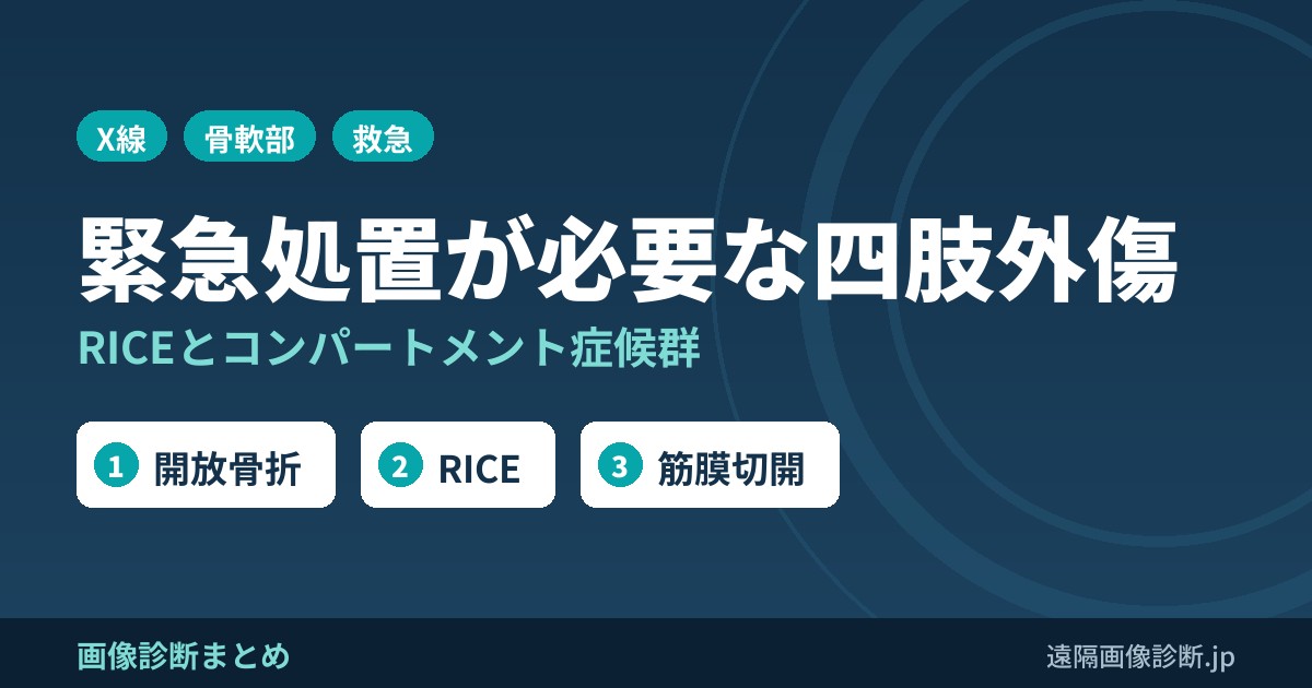 緊急処置が必要な四肢外傷とは？RICEとは？