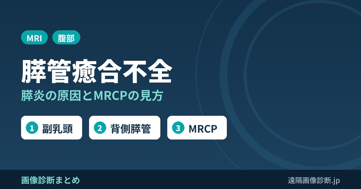 膵管癒合不全(pancreas divisum)とは？膵炎の原因となる仕組みとMRCP画像