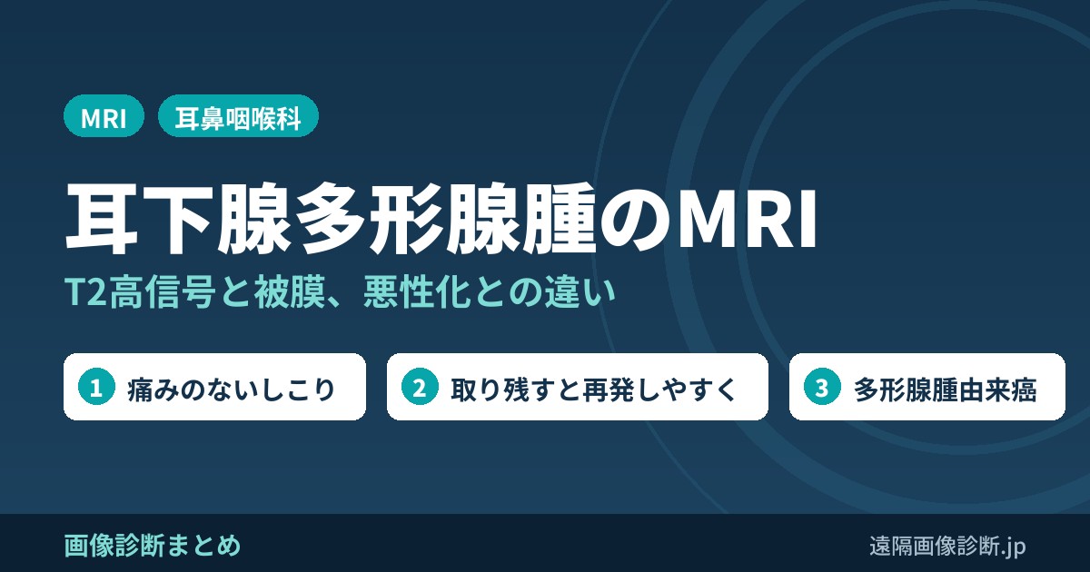 多形腺腫(耳下腺)とは？MRI画像所見(T2高信号・被膜)とワルチン腫瘍・悪性化との違い