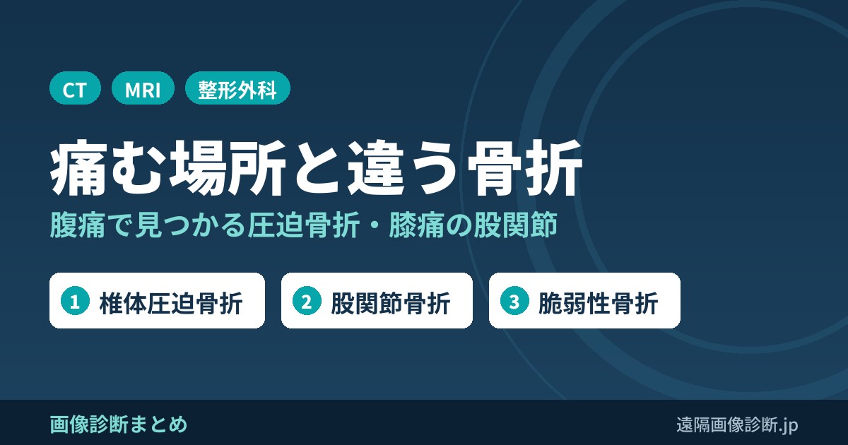 痛む場所と違う骨折 腹痛で見つかる圧迫骨折・膝痛の股関節