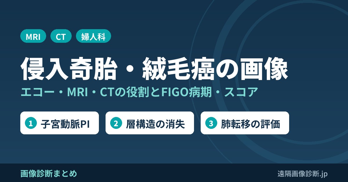 侵入奇胎・絨毛癌の画像 エコー・MRI・CTの役割とFIGO病期・スコア