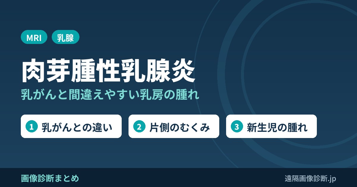 肉芽腫性乳腺炎 乳がんと間違えやすい乳房の腫れ
