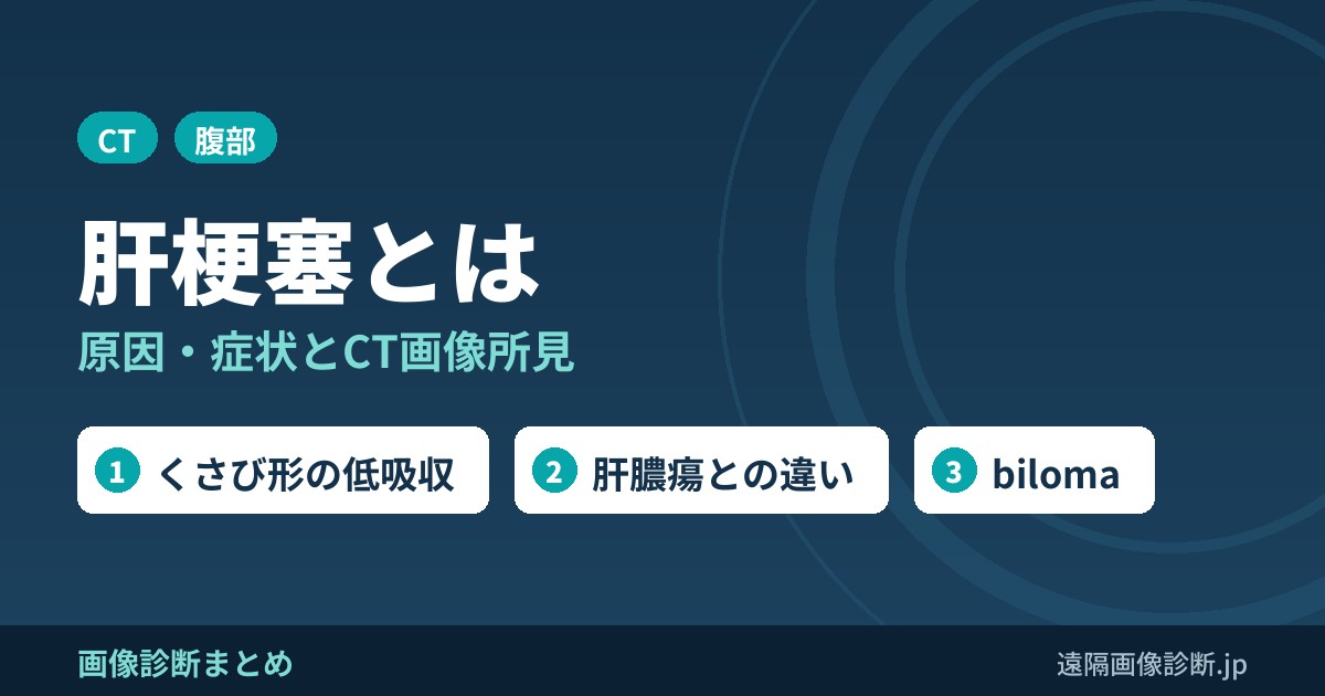 肝梗塞とは 原因・症状とCT画像所見
