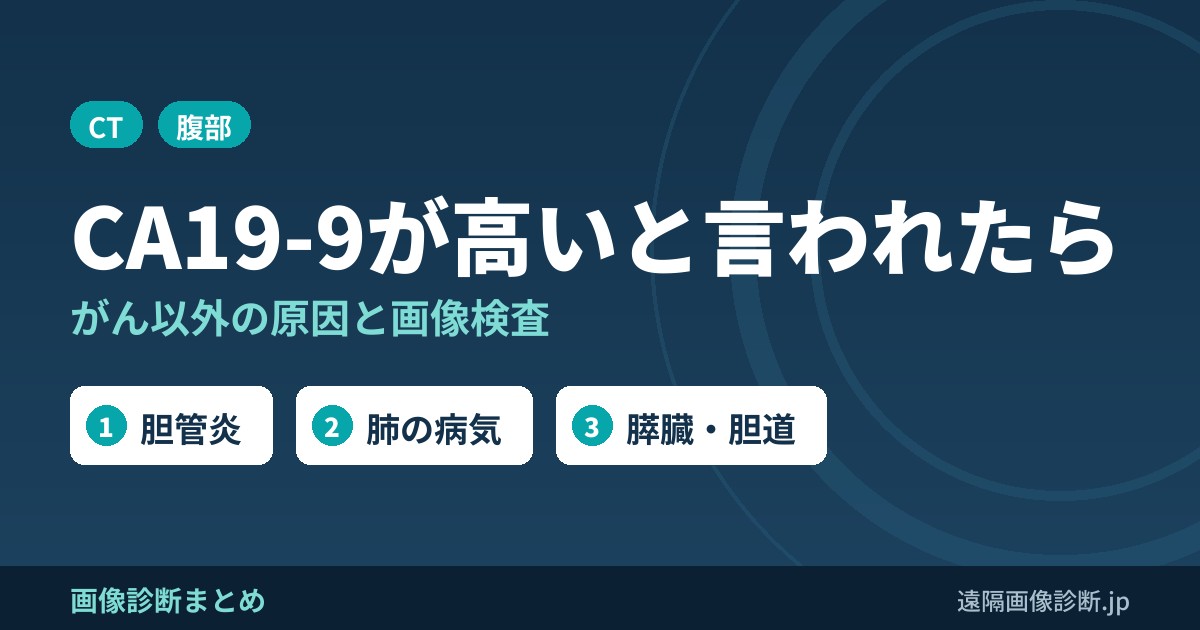 CA19-9が高いと言われたら がん以外の原因と画像検査