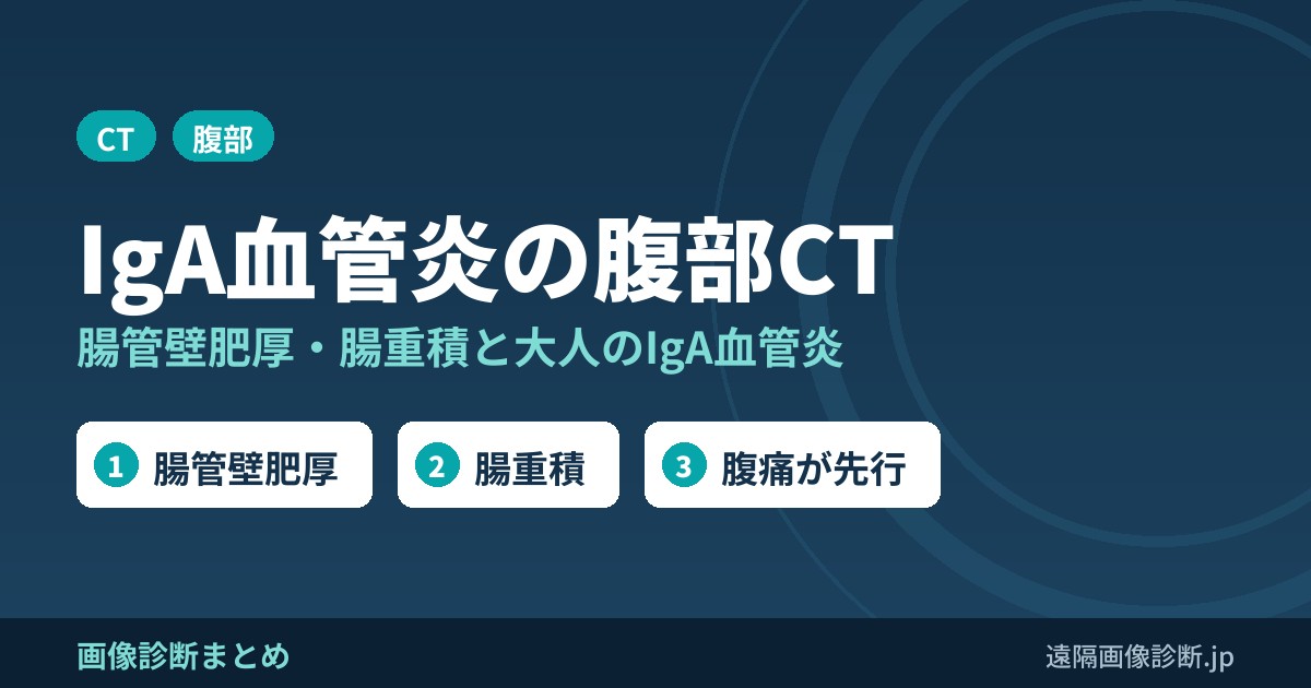 IgA血管炎の腹部CT 腸管壁肥厚・腸重積と大人のIgA血管炎