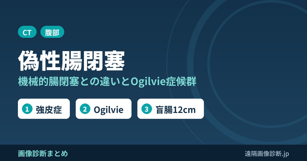 偽性腸閉塞 機械的腸閉塞との違いとOgilvie症候群