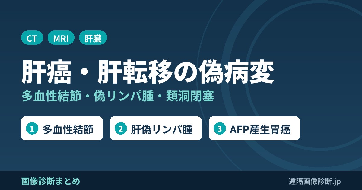 肝癌・肝転移の偽病変 多血性結節・偽リンパ腫・類洞閉塞