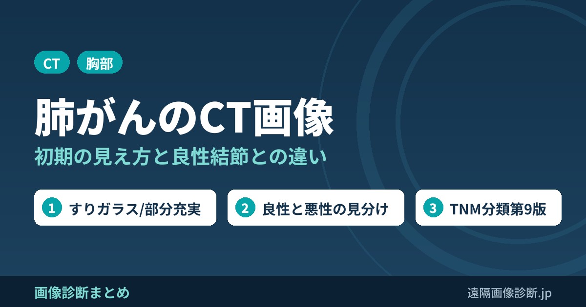 肺がんのCT画像 初期の見え方と良性結節との違い